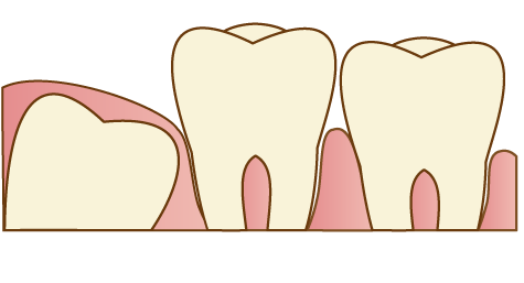 スタッフブログ 歯医者さんでエクササイズ ナチュラル ハーモニー